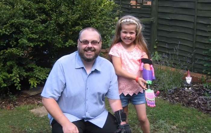 8-річна дівчинка-інвалід отримала дизайнерський 3D-протез (7 фото)