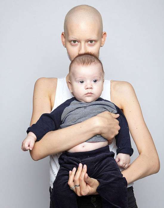 Хвора на рак дівчина народила дитину, незважаючи на рекомендації лікарів (13 фото)