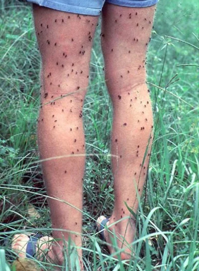 Секретный способ защиты от комаров без всяких репеллентов не всё так грустно,самоделкин