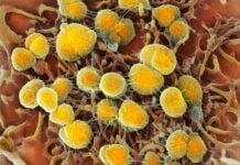 FDA keurt nieuwe antibiotica goed om de toenemende gevallen van gonorroe te bestrijden