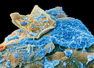 Souvislost mezi orálním mikrobiálním složením a obezitou: možná včasná diagnóza a prevence