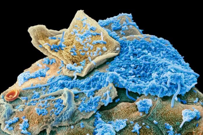 ba23adc0-62f3-4b86-bec9-e74af8ba40c2