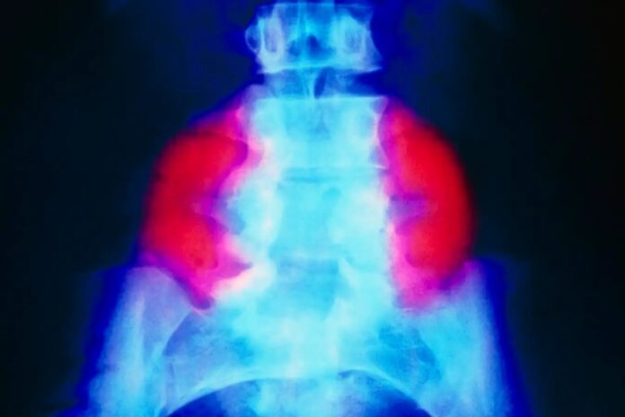 28be0aca-8da9-4b79-b30a-85a95d059fd0