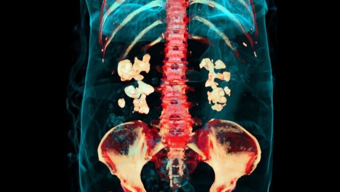 98e52b07-23d7-4377-b499-e569907ae3c5