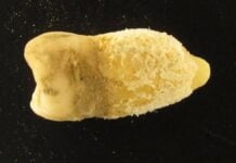 Зуб болівійської мумії переписує історію скарлатини