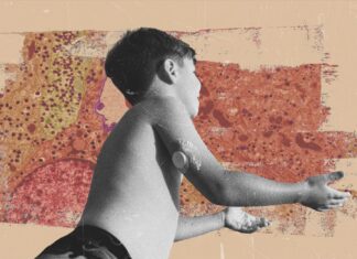 За пределами инсулиновых «качелей»: станет ли функциональное излечение от диабета 1 типа реальностью?