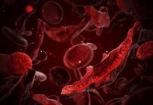 Прорыв CRISPR: ученые получили 3 миллиона долларов за новаторскую терапию серповидноклеточной анемии