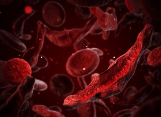 La svolta CRISPR: agli scienziati sono stati assegnati 3 milioni di dollari per la pionieristica terapia con cellule falciformi